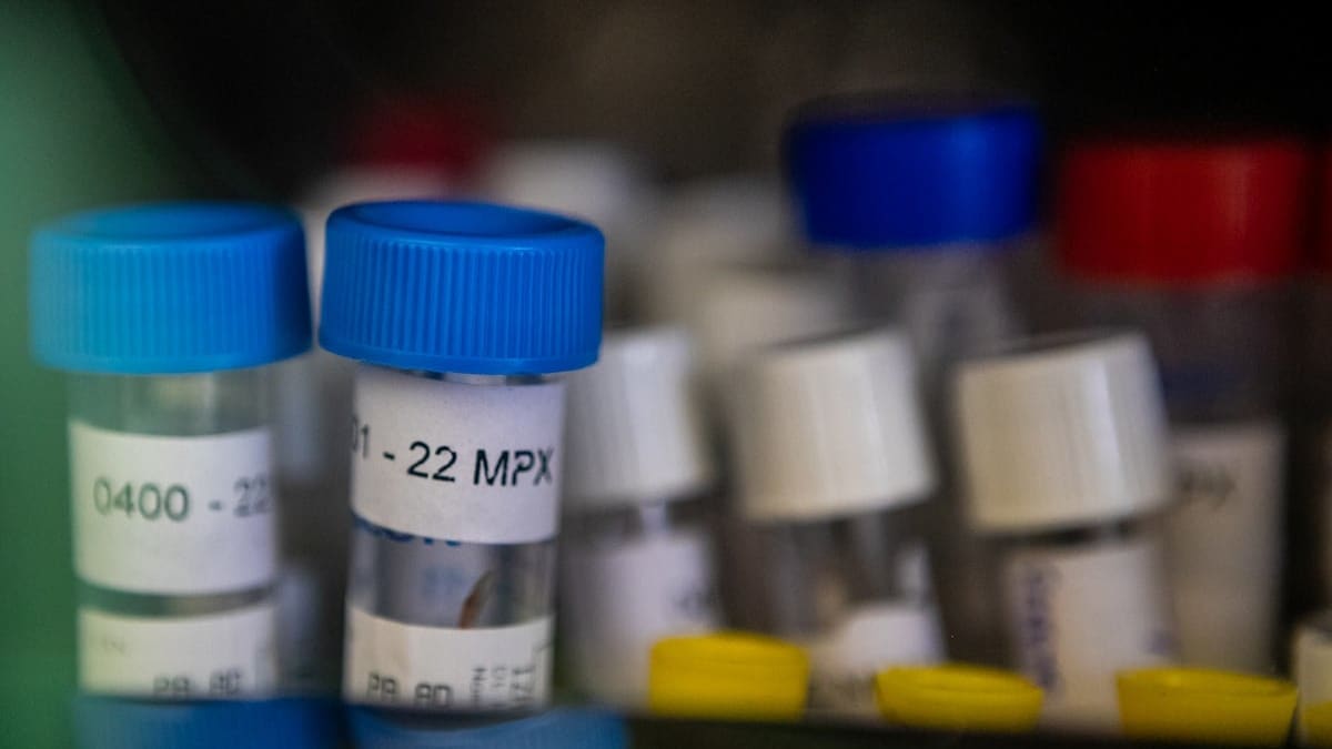 Paraná registra primeiro caso de Mpox em 2026; Brasil tem 88 confirmados