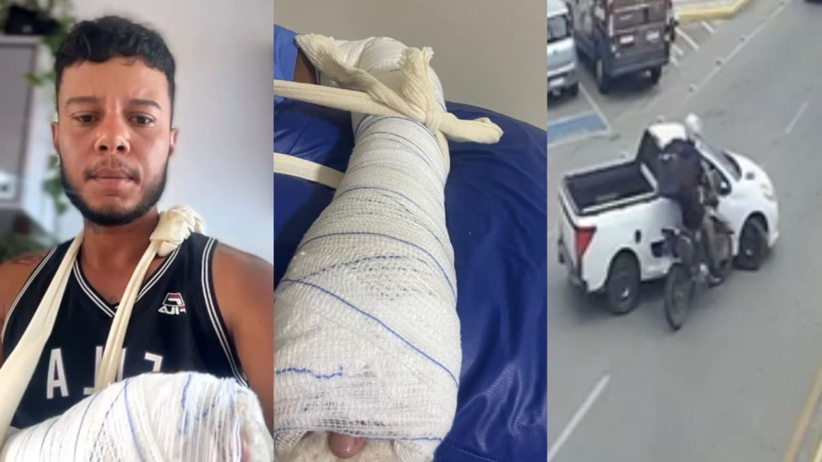 Motoboy sofre fratura exposta após ter frente cortada por carro em Tijucas