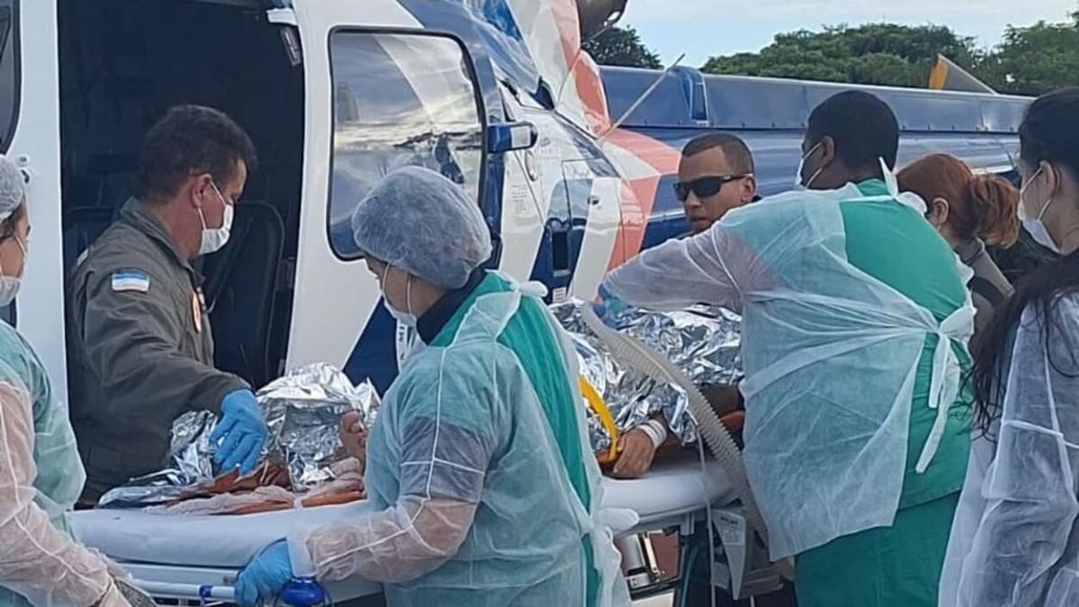 Jovem sofre queimaduras graves ao acender churrasqueira com álcool em Guarapari