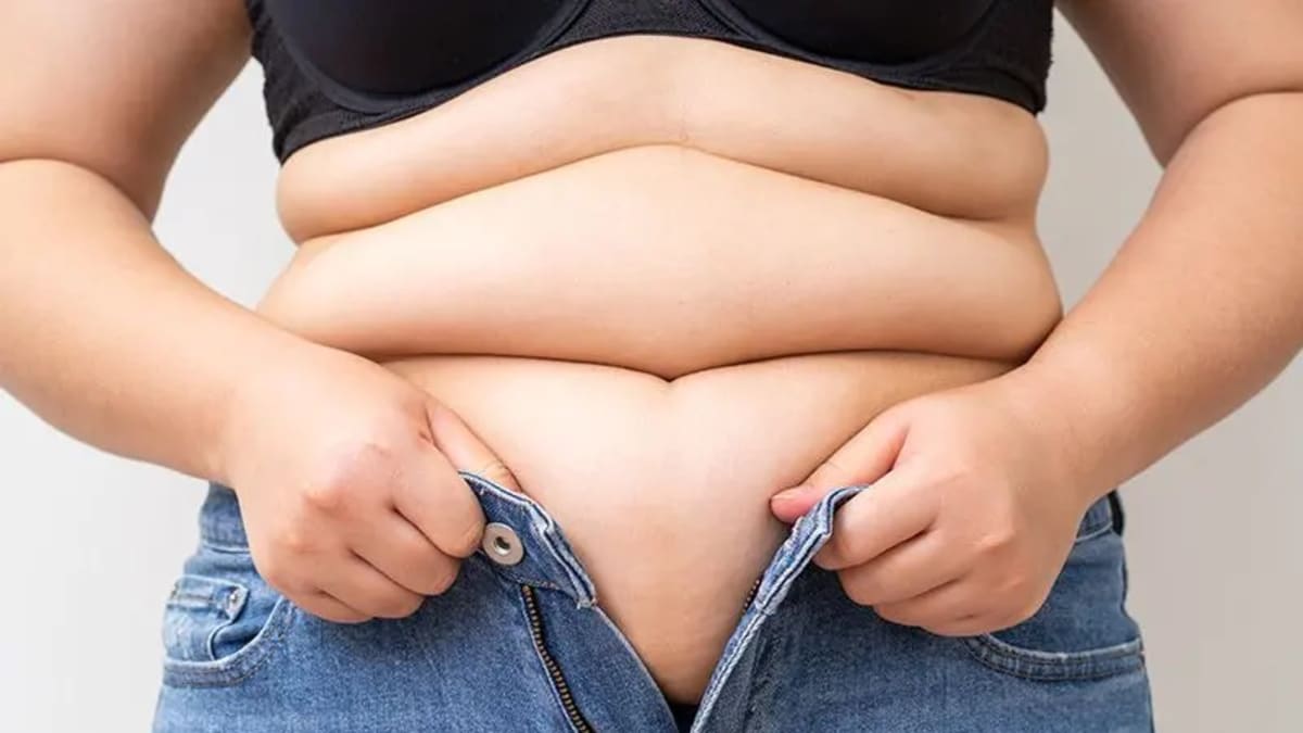 Obesidade avança no Brasil e bariátrica segue como “padrão-ouro” em casos específicos, diz cirurgião