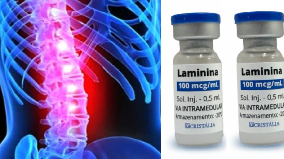 Pesquisa com polilaminina da UFRJ mostra avanços em recuperação de lesão medular