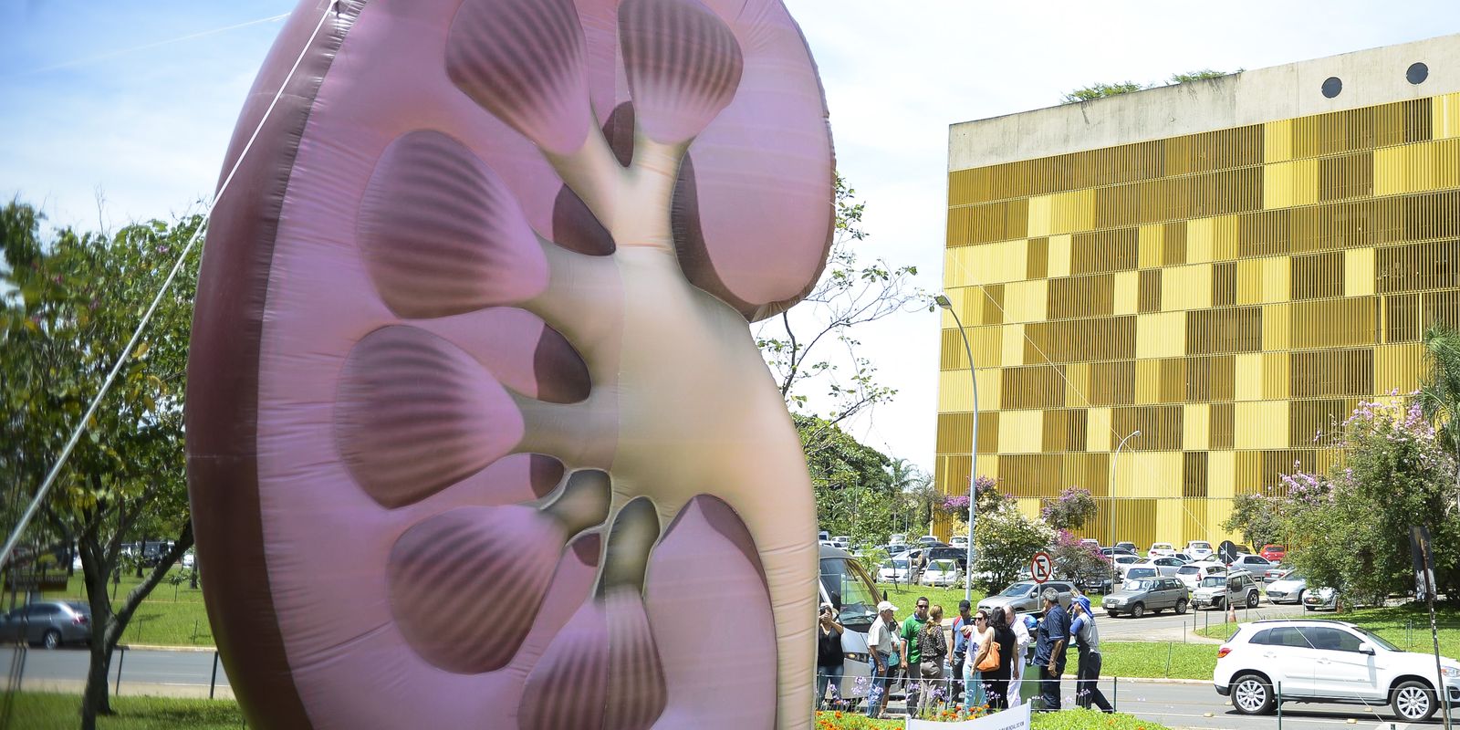 Doença renal crônica ganha destaque mundial em saúde pública