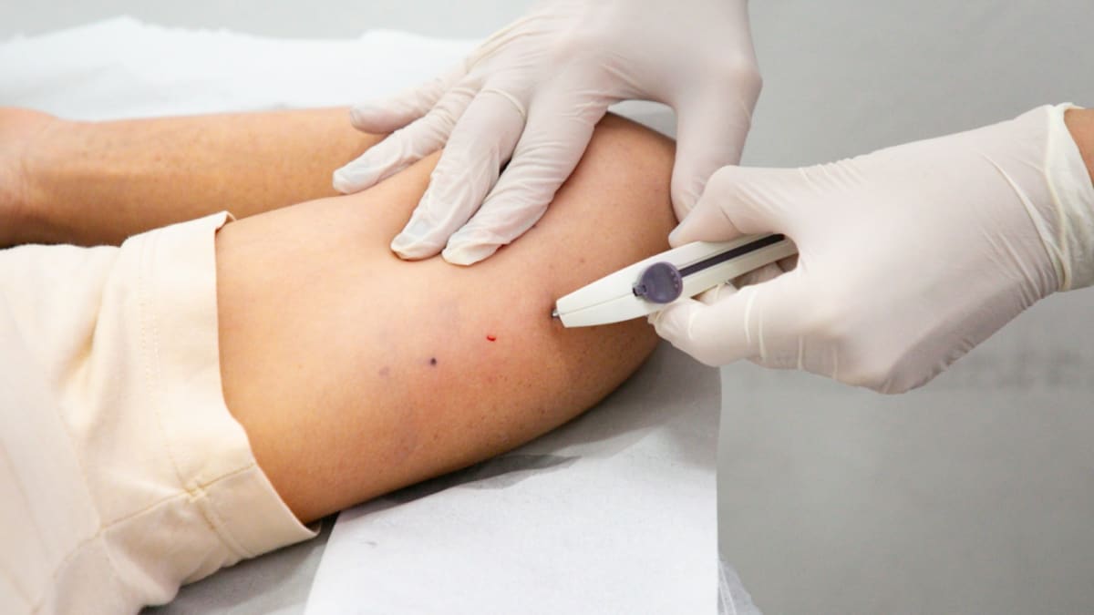 Itaguaí inicia oferta do implante contraceptivo Implanon pelo SUS