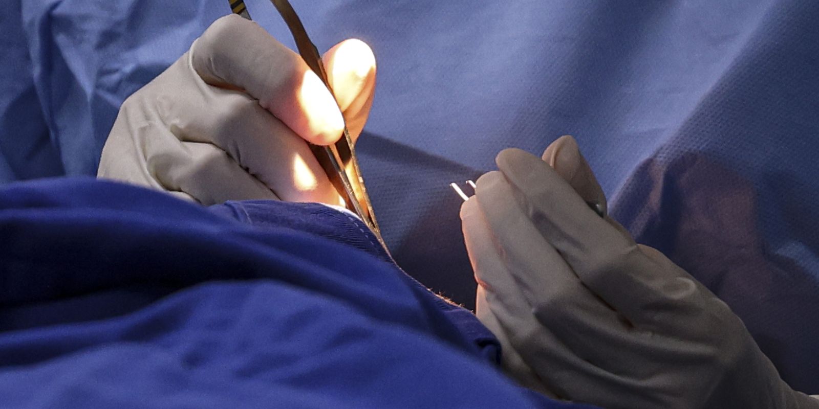 Maior mutirão do SUS para saúde da mulher mobiliza hospitais em todo o país