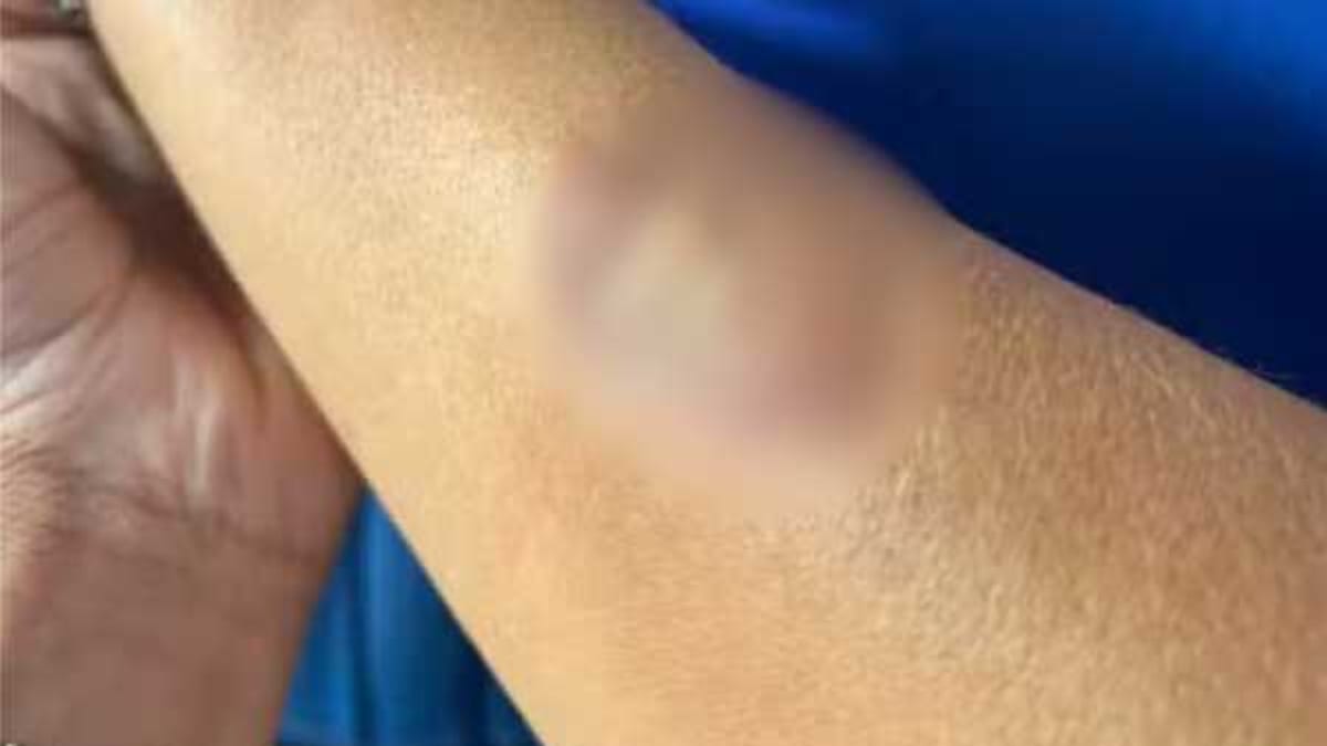 Mãe agride funcionárias e morde vice-diretora em escola estadual no Paraná