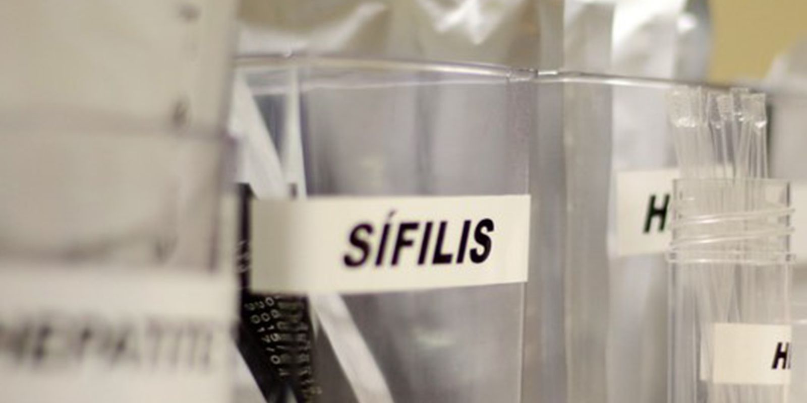 Testes rápidos gratuitos na Praça Roosevelt