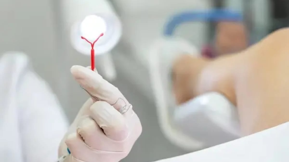 Governo de Goiás realiza mutirão para inserção de DIU em Goiânia e Aparecida de Goiânia