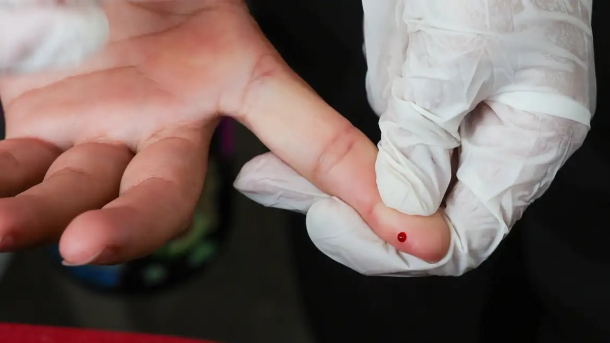 SUS passa a oferecer teste rápido para diagnóstico da dengue na rede pública