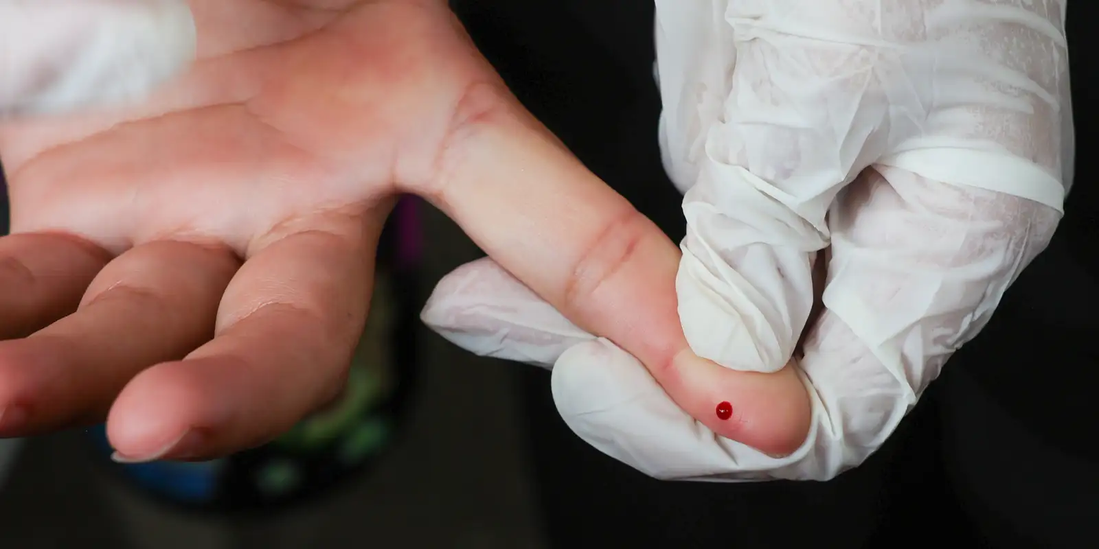 Ministério da Saúde inclui teste rápido de dengue no SUS