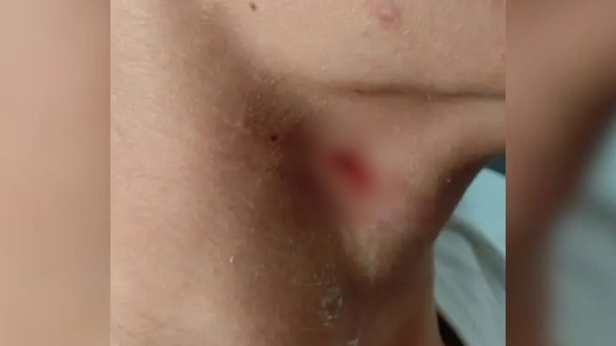 Adolescente é ferido no pescoço por colega dentro de colégio cívico-militar em Ponta Grossa