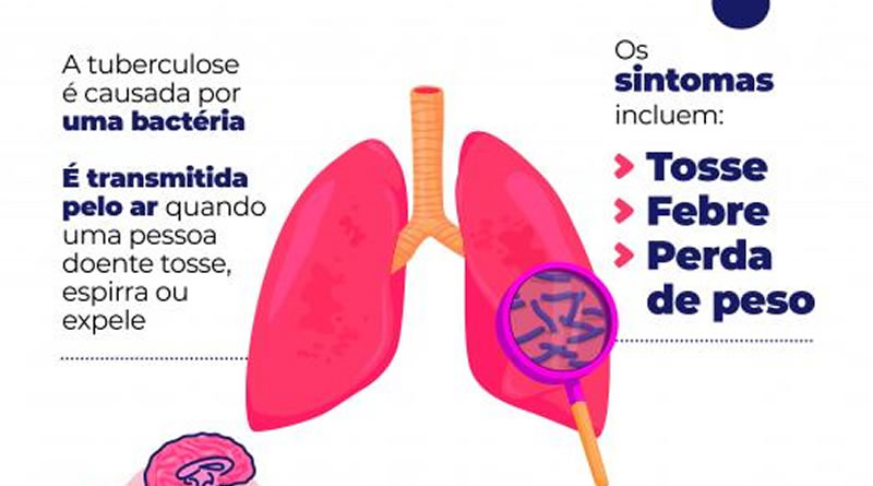Campanha contra a tuberculose será permanente em Santos