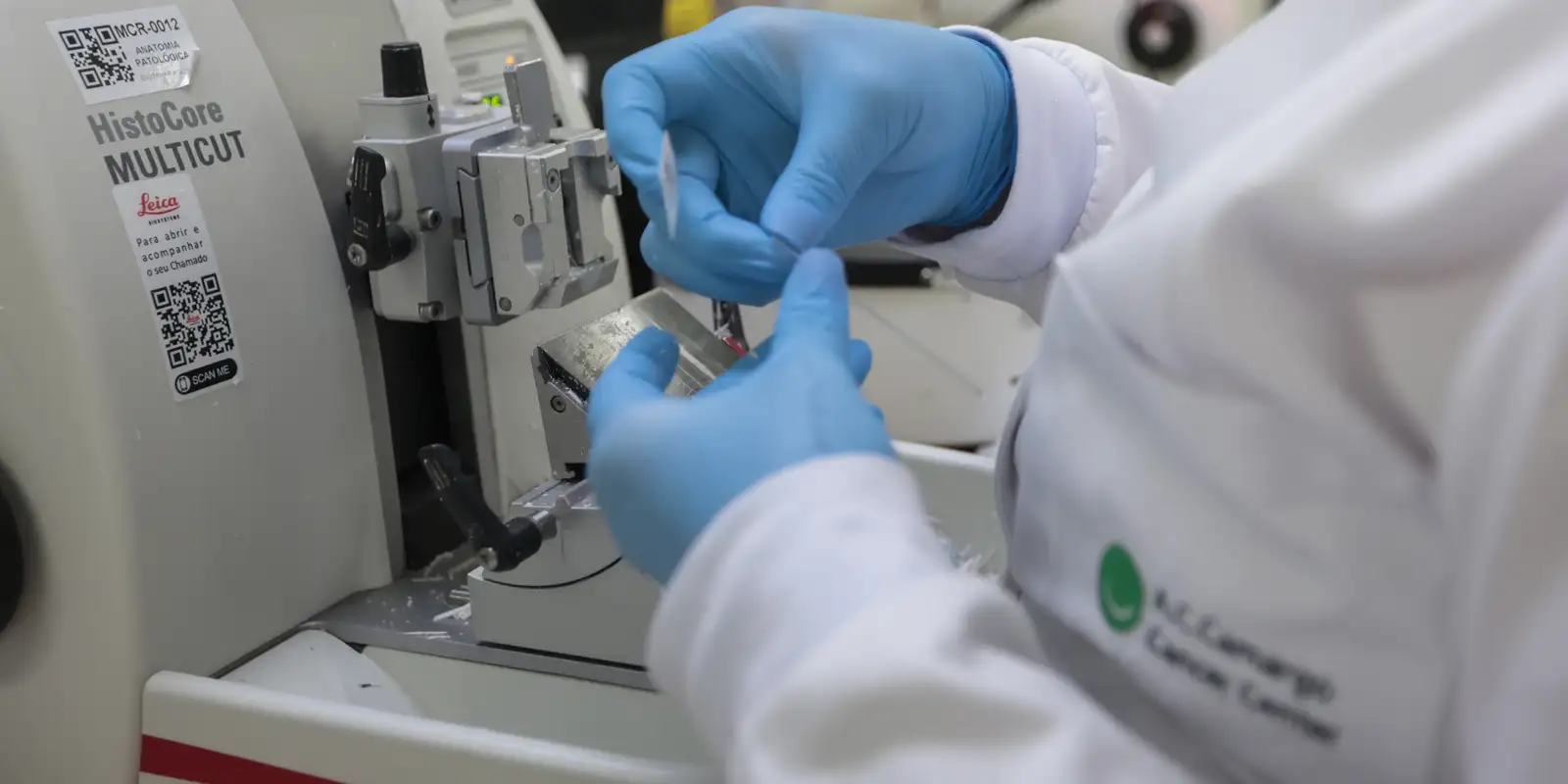 Cirurgia robótica para câncer de próstata é incorporada ao SUS e planos de saúde