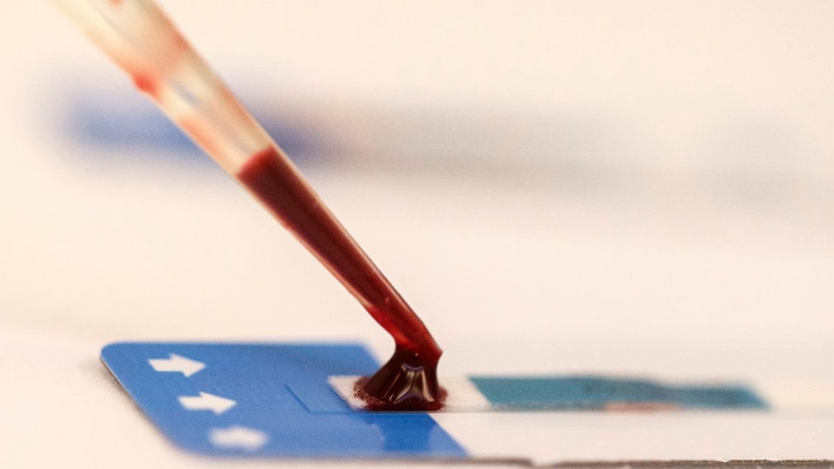 Fiocruz Bahia lança estudo para ampliar prevenção do HIV entre jovens na periferia