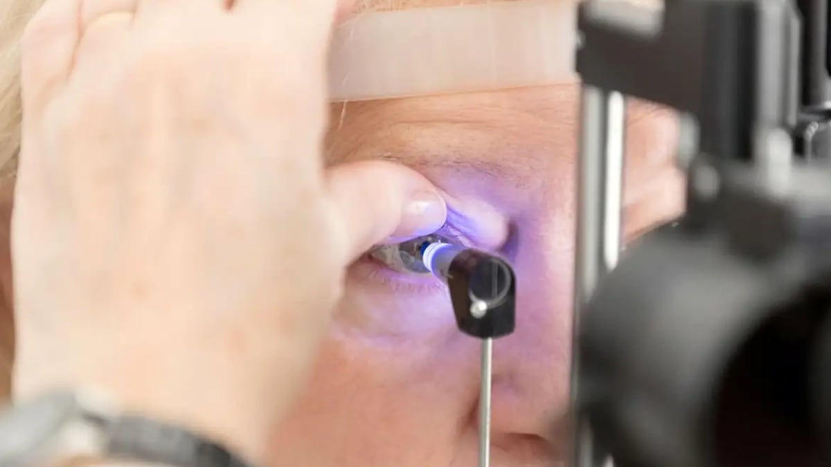 STF confirma direito à aposentadoria para pessoas com visão monocular como PCD