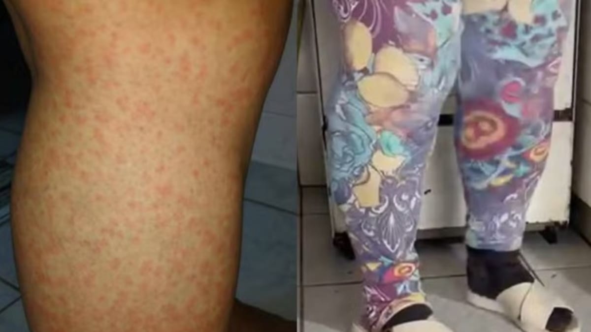 Moradores de Ilhota vivem reféns de infestação de maruins com temperaturas acima de 34°C