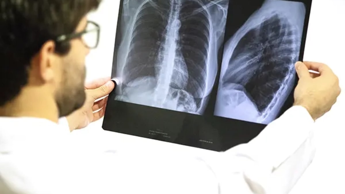 Goiás decreta emergência por alta de SRAG e abre 564 leitos na rede estadual