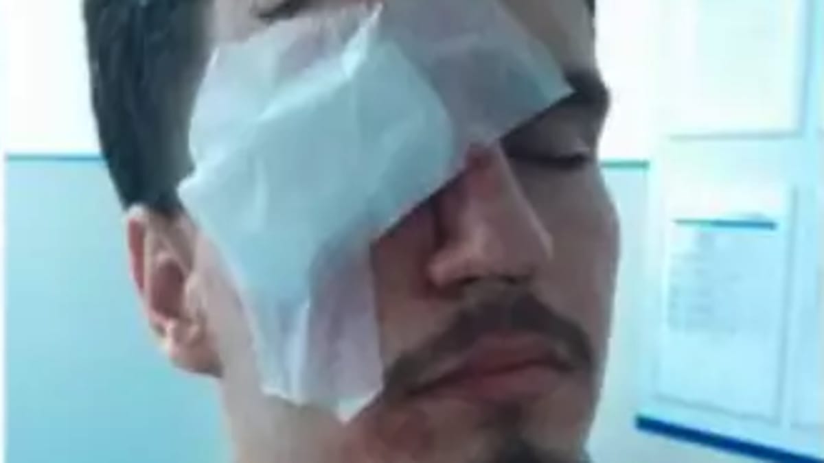 Estudante da Uerj perde visão após disparo de bala de borracha no Maracanã