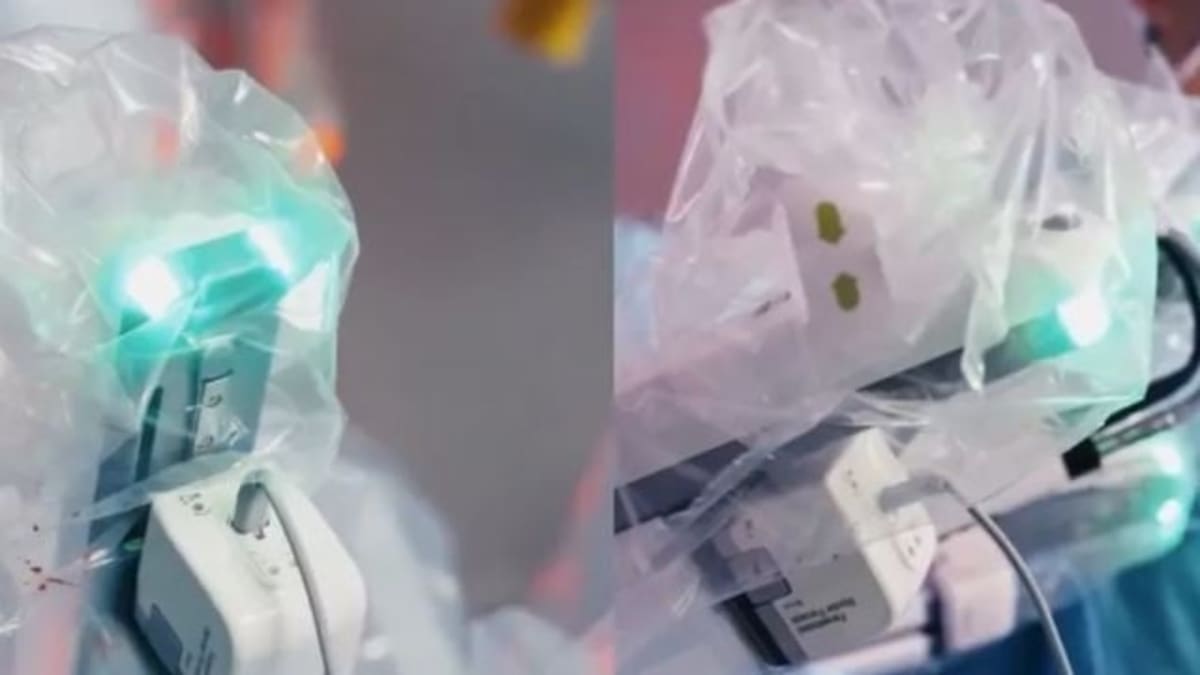 Cirurgia robótica é realizada com comando remoto entre China e Porto Alegre