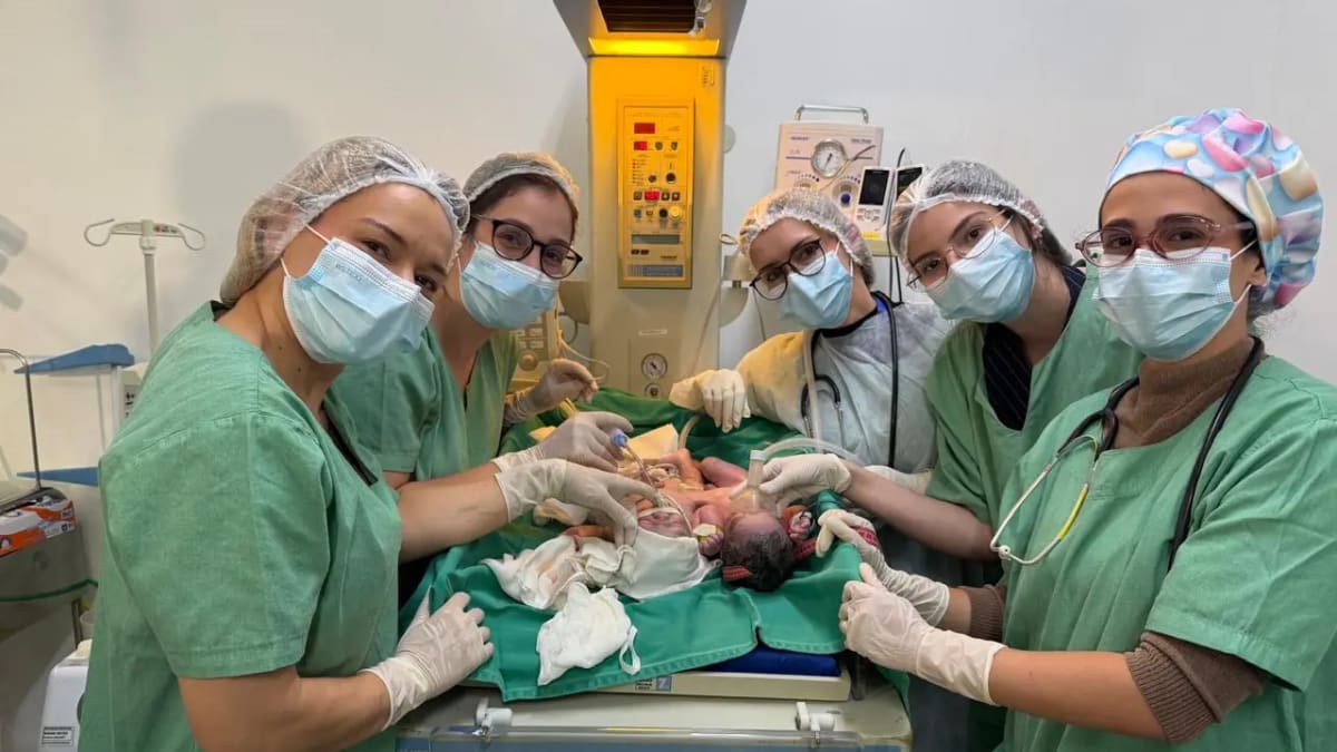 Nascimento de gêmeos siameses no Hospital Estadual da Mulher em Goiânia é acompanhado por equipe médica especializada