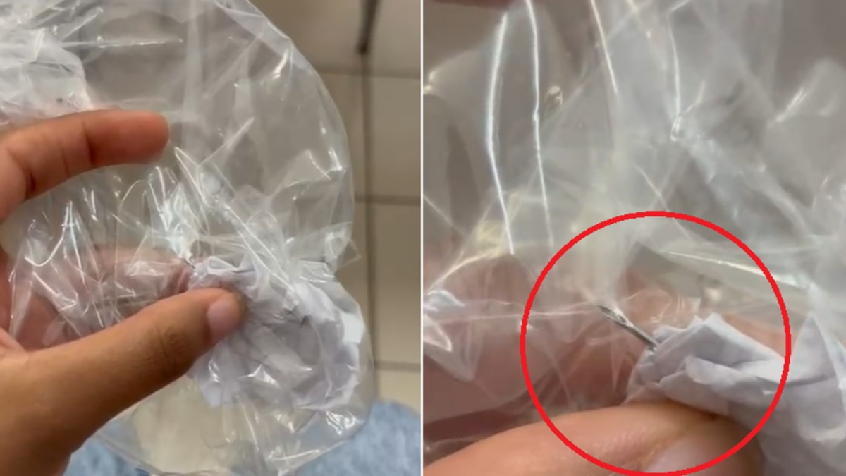 Agulha é encontrada em refeição servida no Restaurante Universitário da Ufes