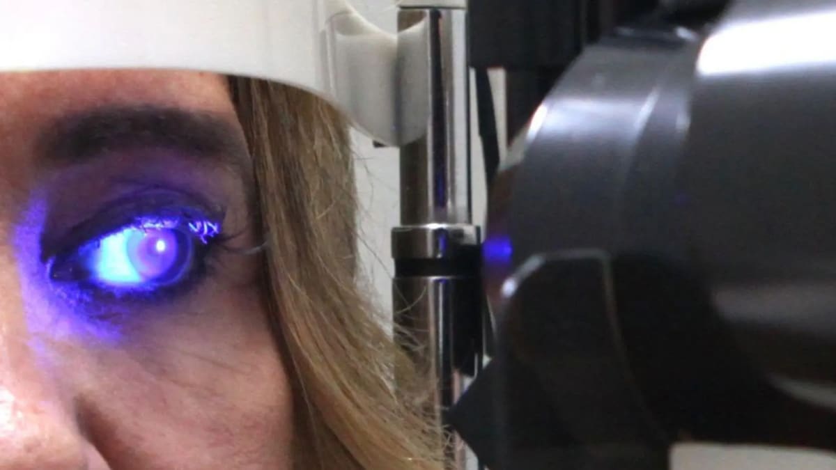 Inteligência artificial será usada para identificar doadores de córneas em Goiás