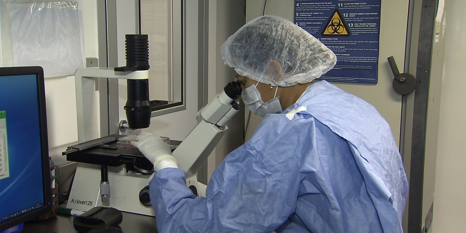 Novos casos de remissão do HIV após transplante de células-tronco