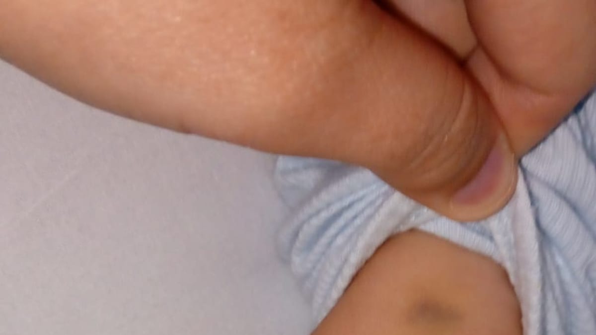 Famílias denunciam falhas no atendimento a crianças no HMISC em Criciúma