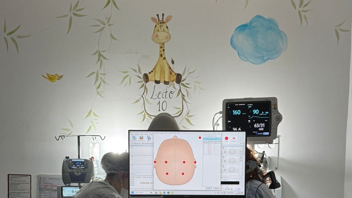 Hospital Jaraguá implanta monitoramento cerebral inovador para recém-nascidos em SC