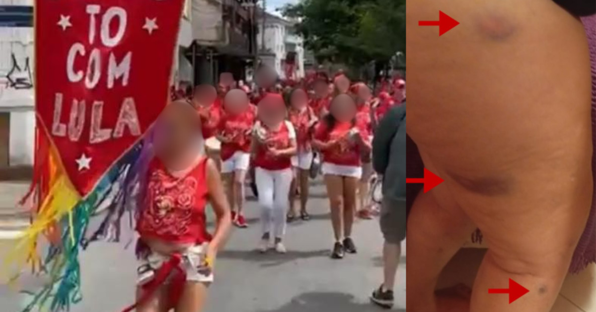 Morador de Florianópolis dispara tiros de chumbinho contra membro do bloco de samba ‘Tô com Lula’